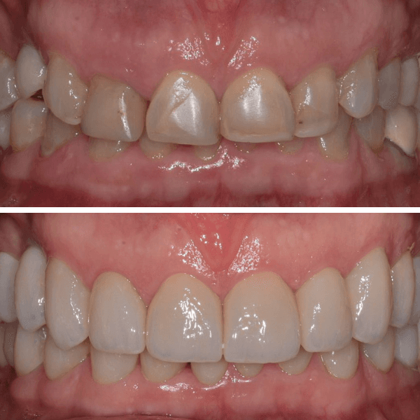 Rehabilitación Oral Integral